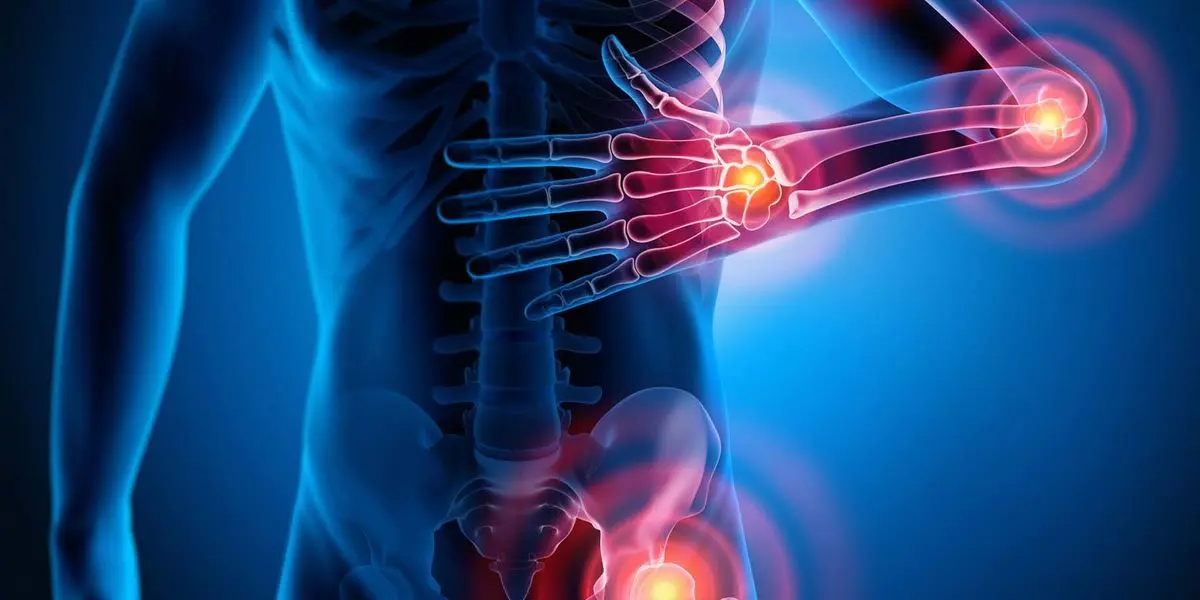 Everything You Want to Know About Rheumatoid Arthritis