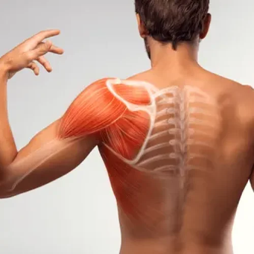 Polymyositis: Symptoms, Causes, Diagnosis, Treatment