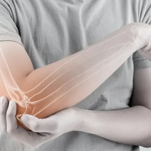 Reactive arthritis | Causes, symptoms, treatments